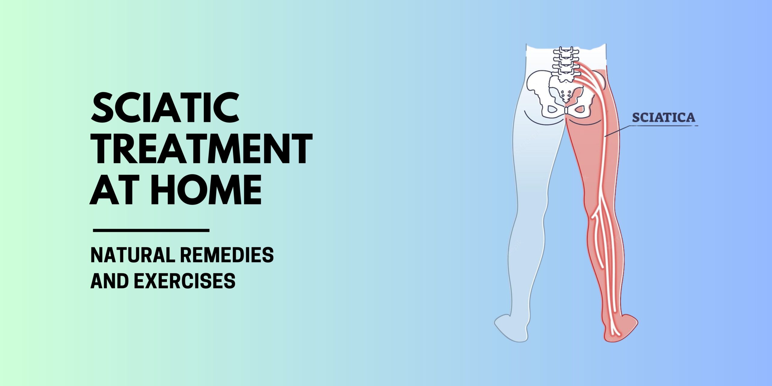 Sciatica Treatment at Home: Natural Remedies and Exercises