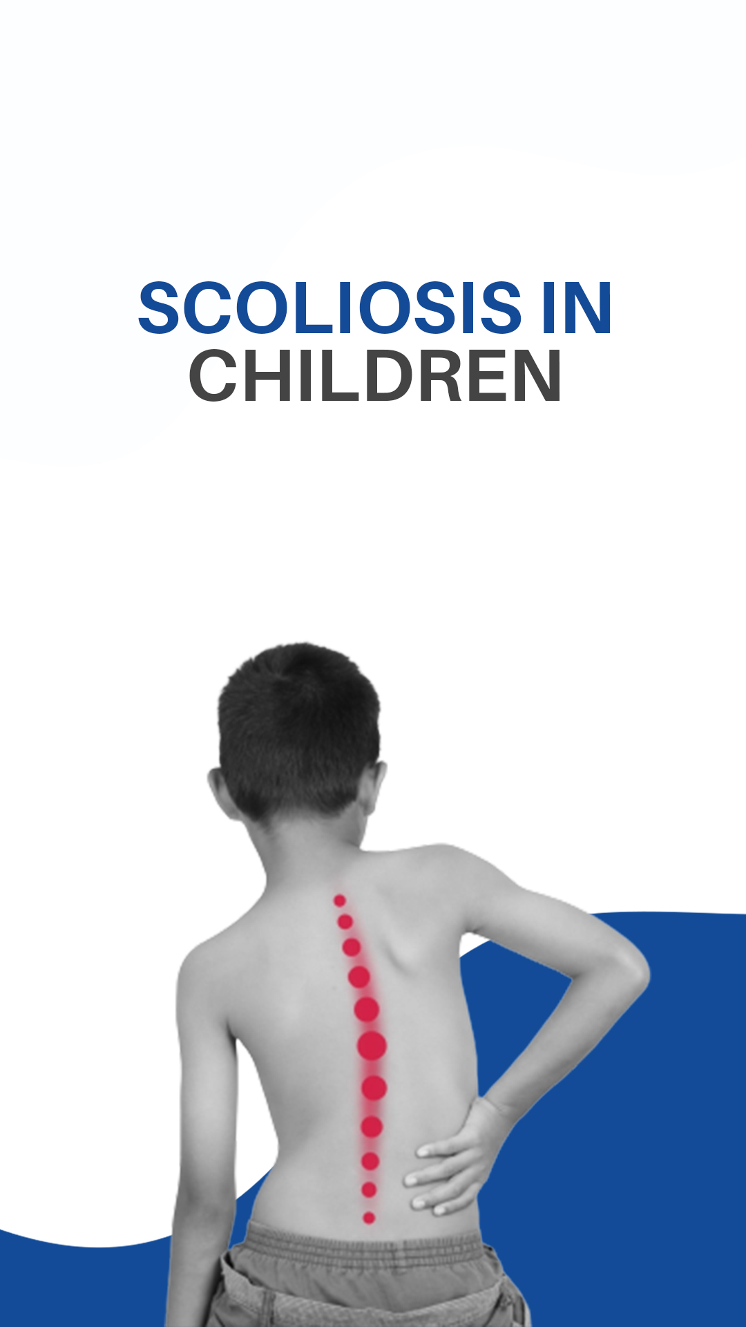 Scoliosis in children