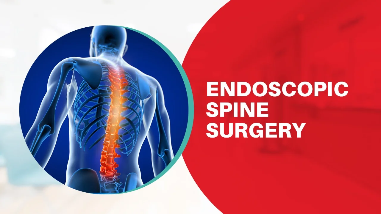 Endoscopic Spine Surgery (ESS)